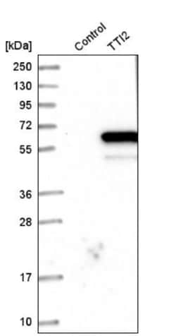 TTI2 Antibody, Novus Biologicals 0.1mL; Unlabeled:Antibodies, Polyclonal